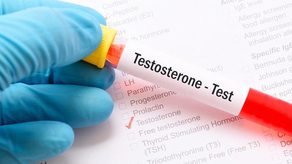 Prueba de testosterona