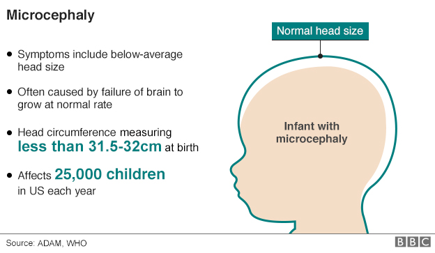 График, показывающий размер головы младенца