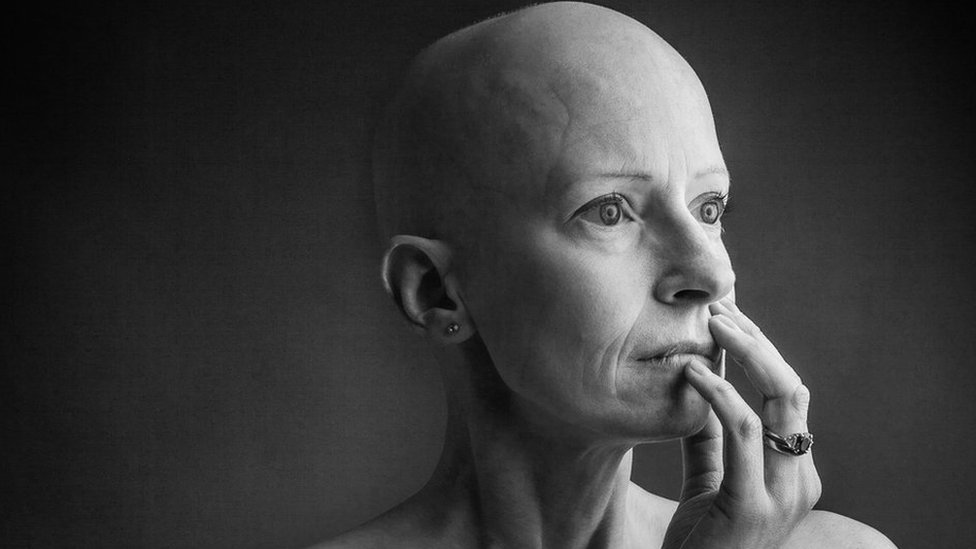 This Painted Photo Series Featuring A Gorgeous Breast Cancer