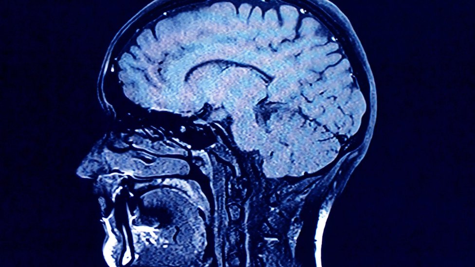 Cérebro em raio-x