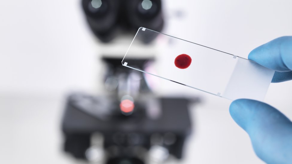Placa de microscopio con gota de sangre