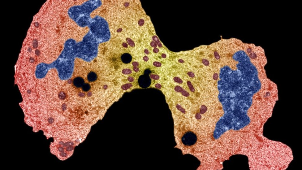 Causas do câncer: as descobertas da maior analise de DNA da doença já feita