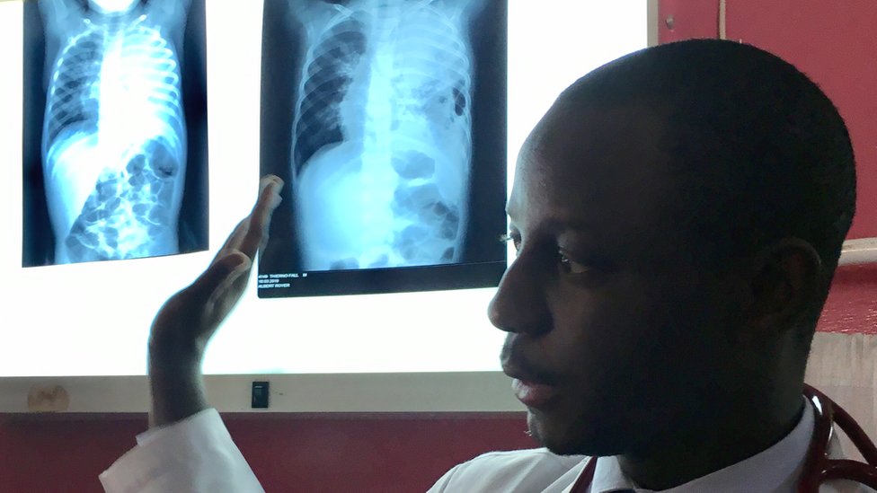 Д-р Идрисса Ба указывает на рентгеновские снимки легких