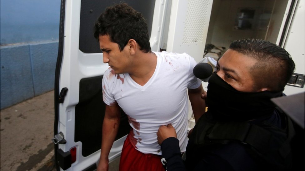 Полицейский сопровождает заключенного, пострадавшего во время драки в тюрьме Эль-Порвенир, когда они прибывают в больницу в Тегусигальпе, Гондурас, 22 декабря 2019 г.