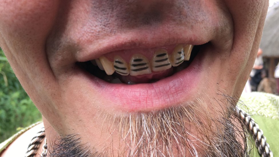 El compromiso con ese estilo de vida de Igor Gorewicz es evidente cuando sonríe. Igor Gorewicz