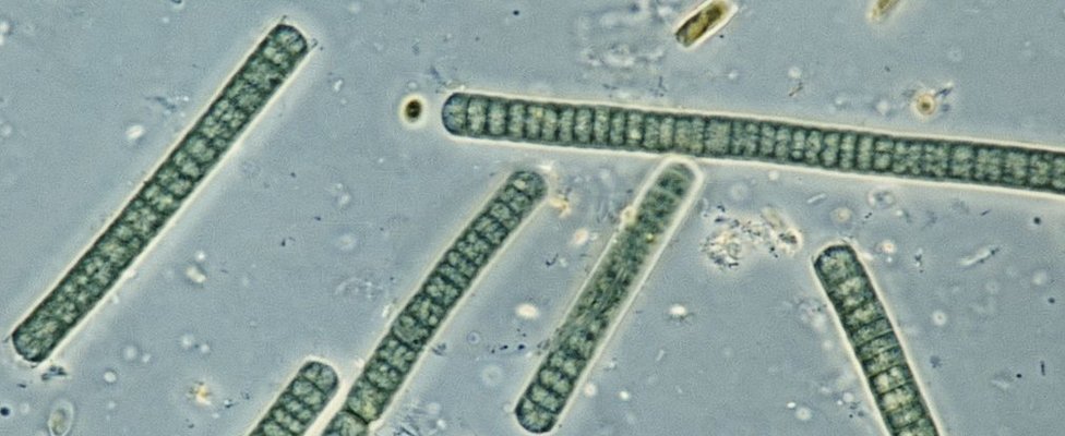 Algas verdiazules, vistas al microscopio.