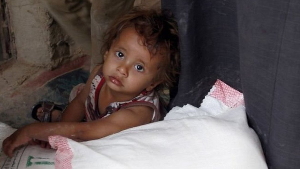 تقدم الأمم المتحدة والمنظمات الإنسانية المساعدة لنحو ثمانية ملايين يمني شهريا