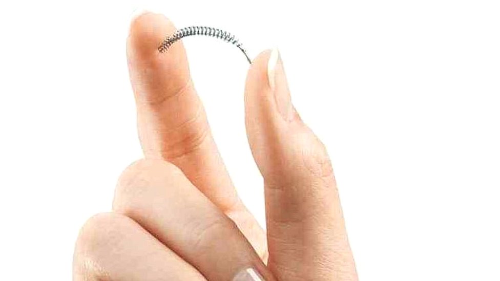 En España, la Agencia Española de Medicamentos y Productos Sanitarios, AEMPS, solicitó a los hospitales que dispongan del dispositivo Essure que no lo usen. Dispositivo Essure