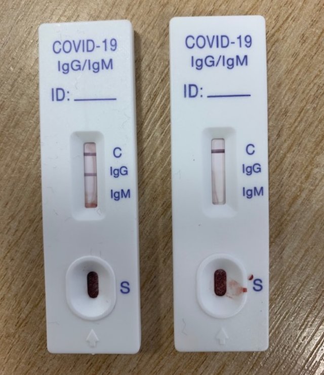 Coronavirus Doctor s Diary So Did The Bradford Choir Have Covid 19 In 
