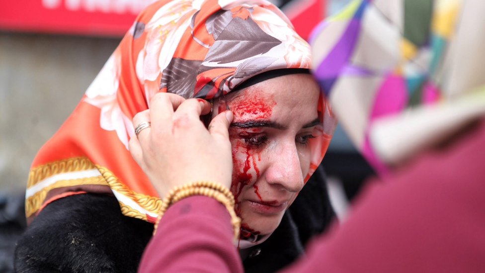 Раздаточная фотография, опубликованная Zaman Daily News, показывает раненую женщину, которой помогают ее друзья во время акции протеста у здания газеты Zaman в Стамбуле, Турция, 5 марта 2016 г. | ||
