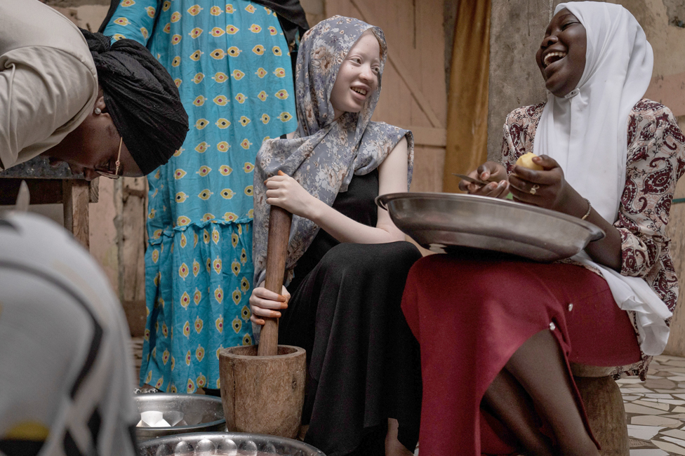فتاة مهقاء تساعد أسرتها في طحن بعض البهارات في السنغال، بالتزامن مع اليوم العالمي للمصابين بالمرض الوراثي