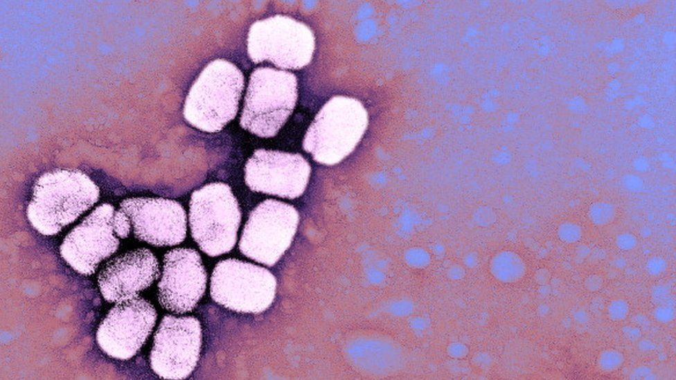 Varíola é causada por um vírus