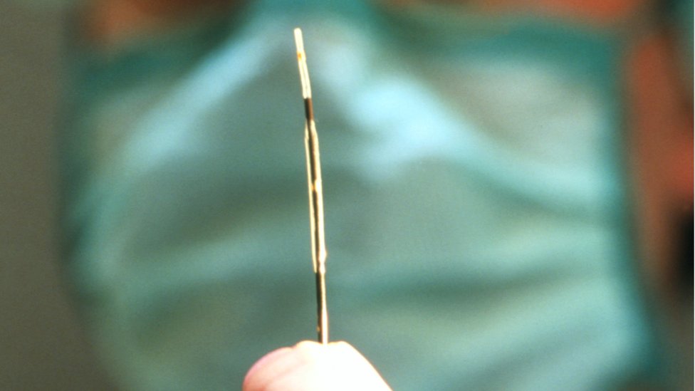 El primer stent para uso en humanos fue patentado con el apellido Palmaz como marca registrada. Stent intravascular