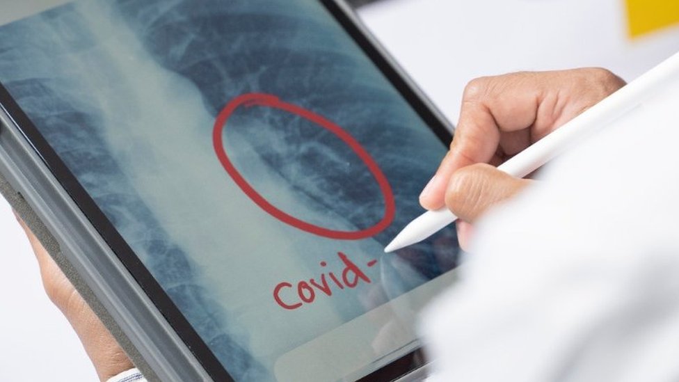 Рентген легких на экране с covid, обведенным красным