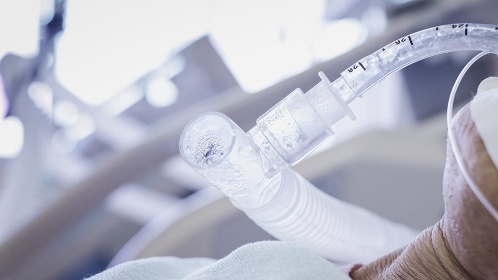 45 пациентов с Covid-19 находились в отделении интенсивной терапии или на искусственной вентиляции легких