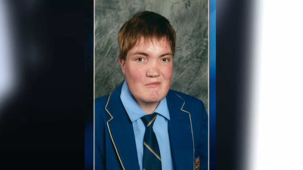 Tim sufrió una complicada operación de cráneo para aliviar la presión sobre su cerebro. Tim, en una foto de su adolescencia