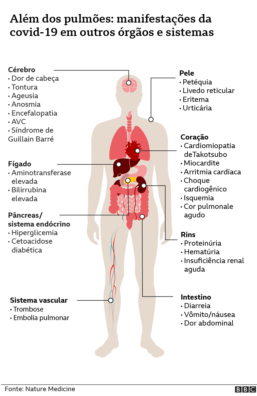 Manifestações da covid-19 em outros órgãos e sistemas