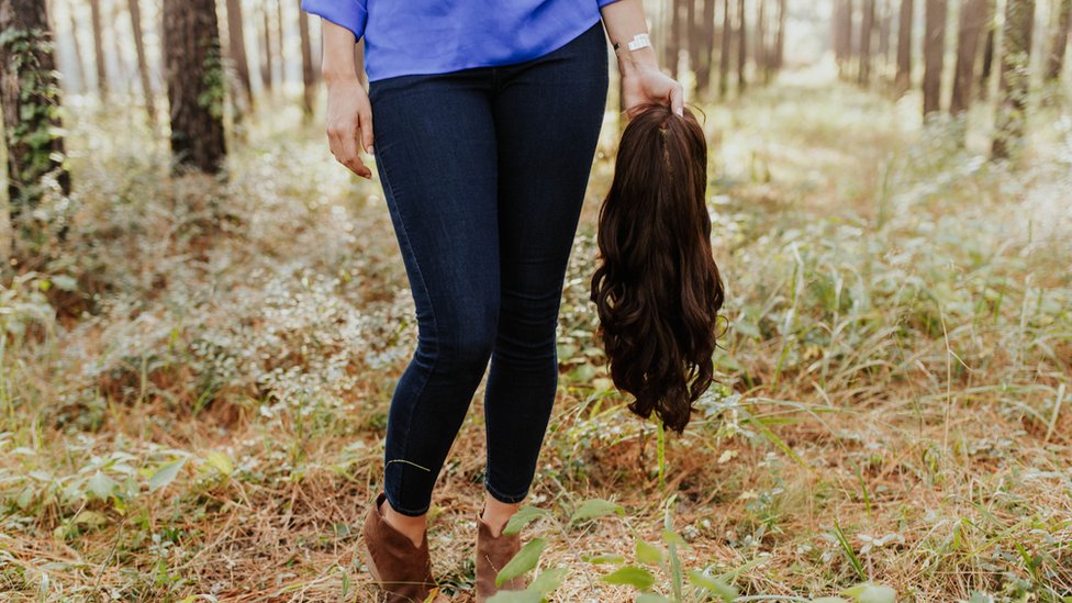 Makenzee también quiere ser fotografiada sin peluca el día de su boda. Makenzee también quiere ser fotografiada sin peluca el día de su boda. (Foto: Frost Collective/Facebbok)