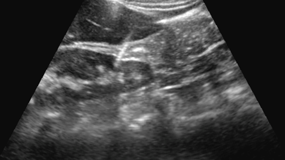 Imagem gerada por ultrassonografia durante autópsia