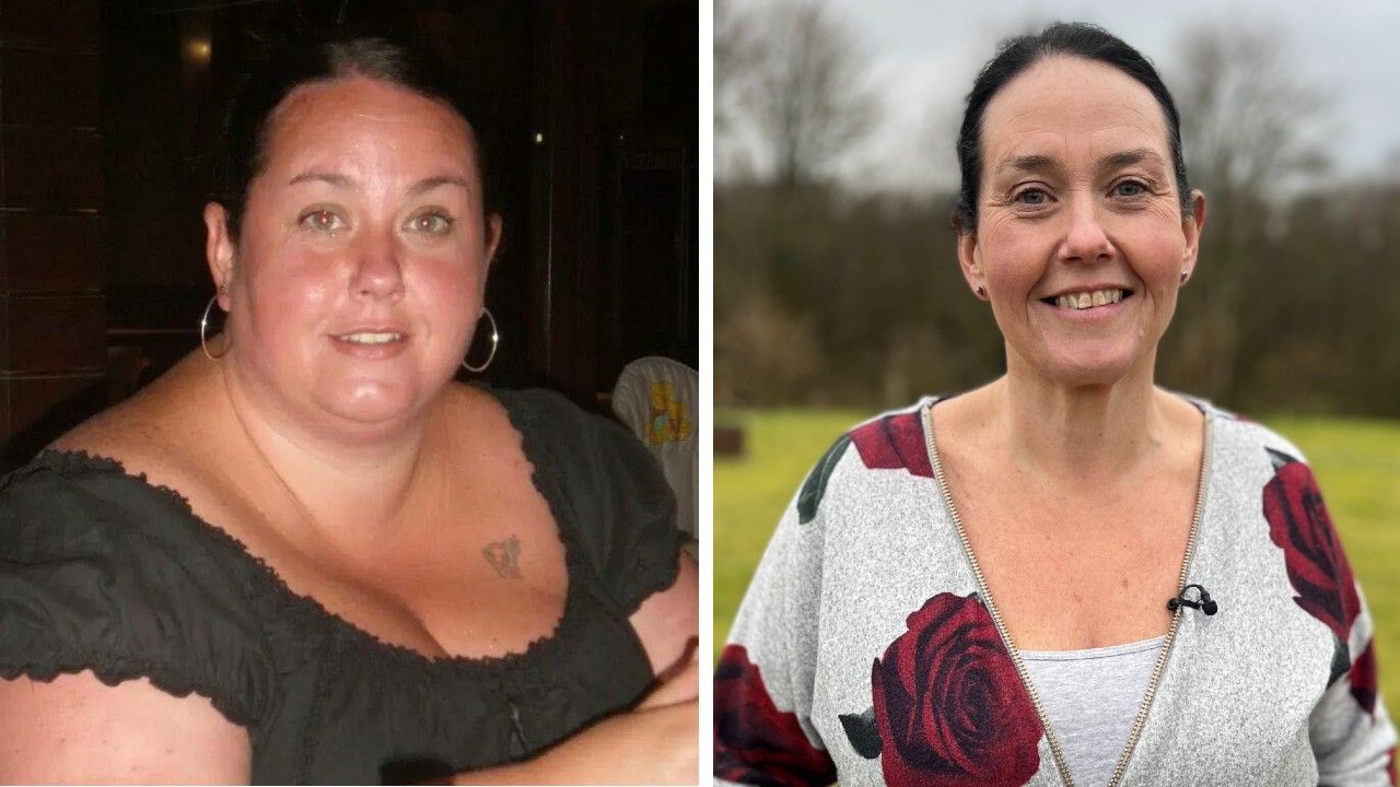 Can I get weight loss drugs on the NHS in Scotland?