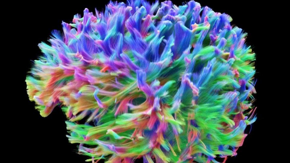 Сканирование мозга