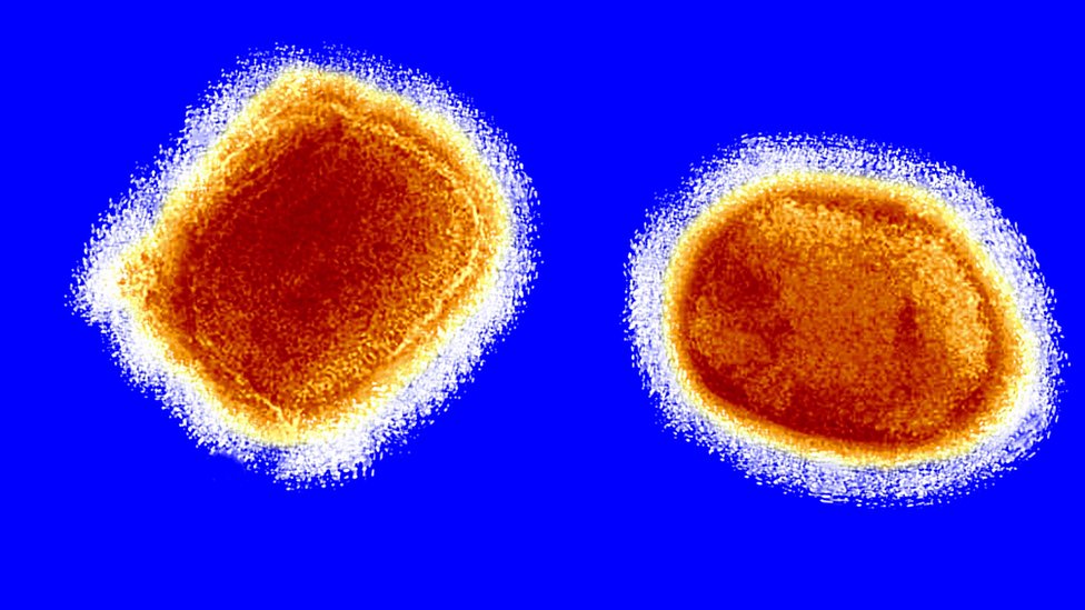 Ilustración de partículas de la viruela del mono.