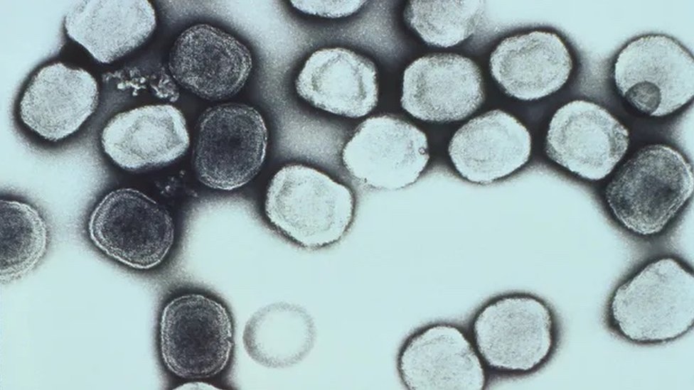 Transmission electron micrograph (TEM) depicting a number of vaccinia virions