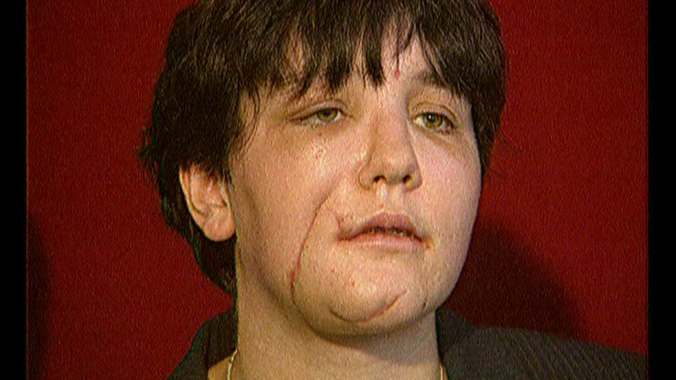 Джули Купер на фото в 2000 году после нападения