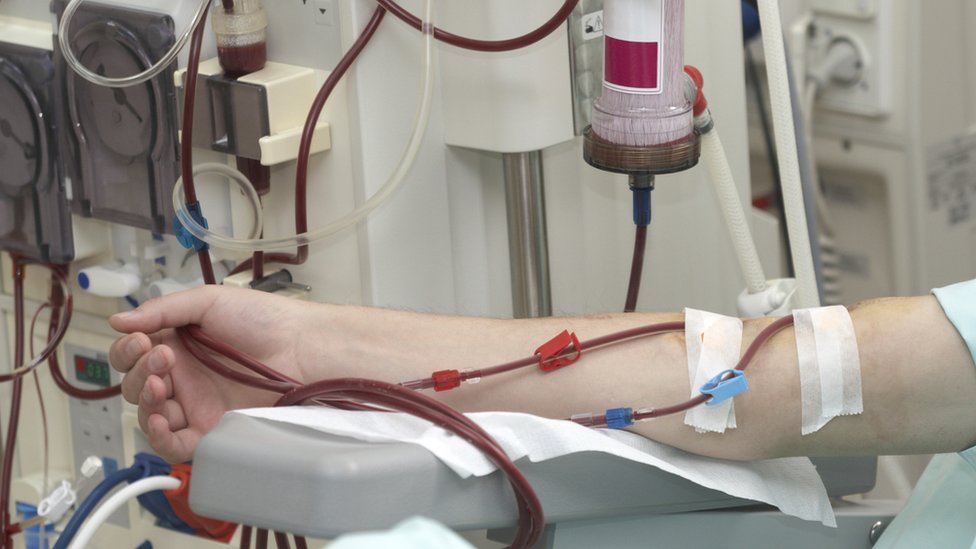 Creeping Privatisation Of Dialysis Services Warns Plaid BBC News