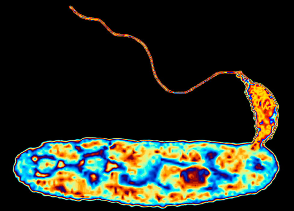 El bdellovidrio utiliza muchas formas de ataque a la vez, mientras que un antibiótico sólo tiene una o dos. Bdellovibrio