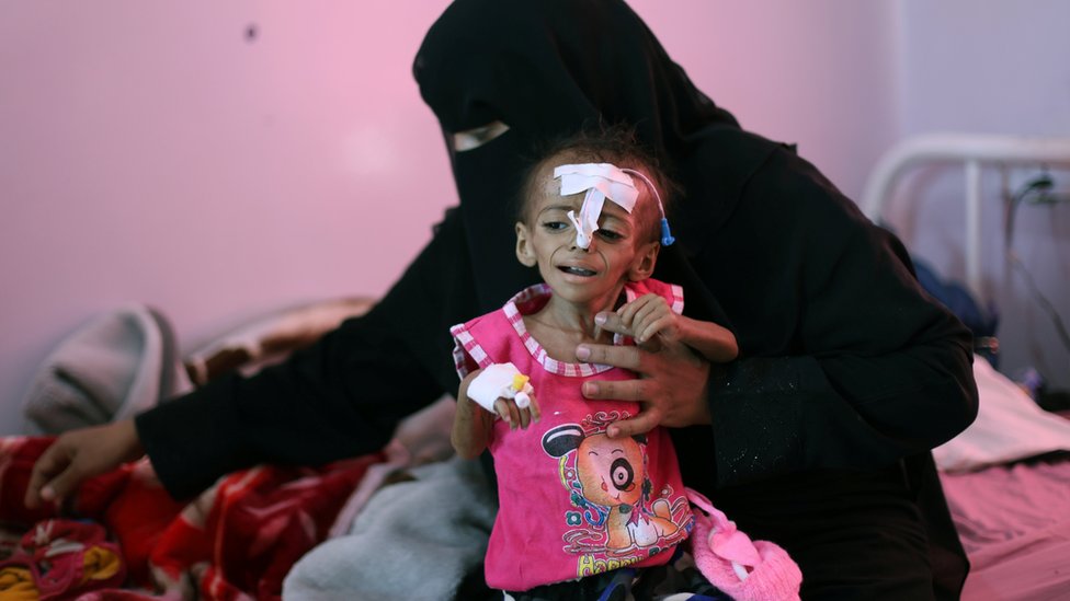 Фотография из архива, на которой запечатлена женщина, держащая свою истощенную дочь в отделении лечения недоедания больницы аль-Сабин в Сане, Йемен 27 октября 2020 г.