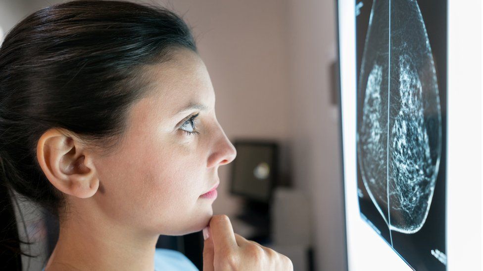 Mujer mirando una mamografía
