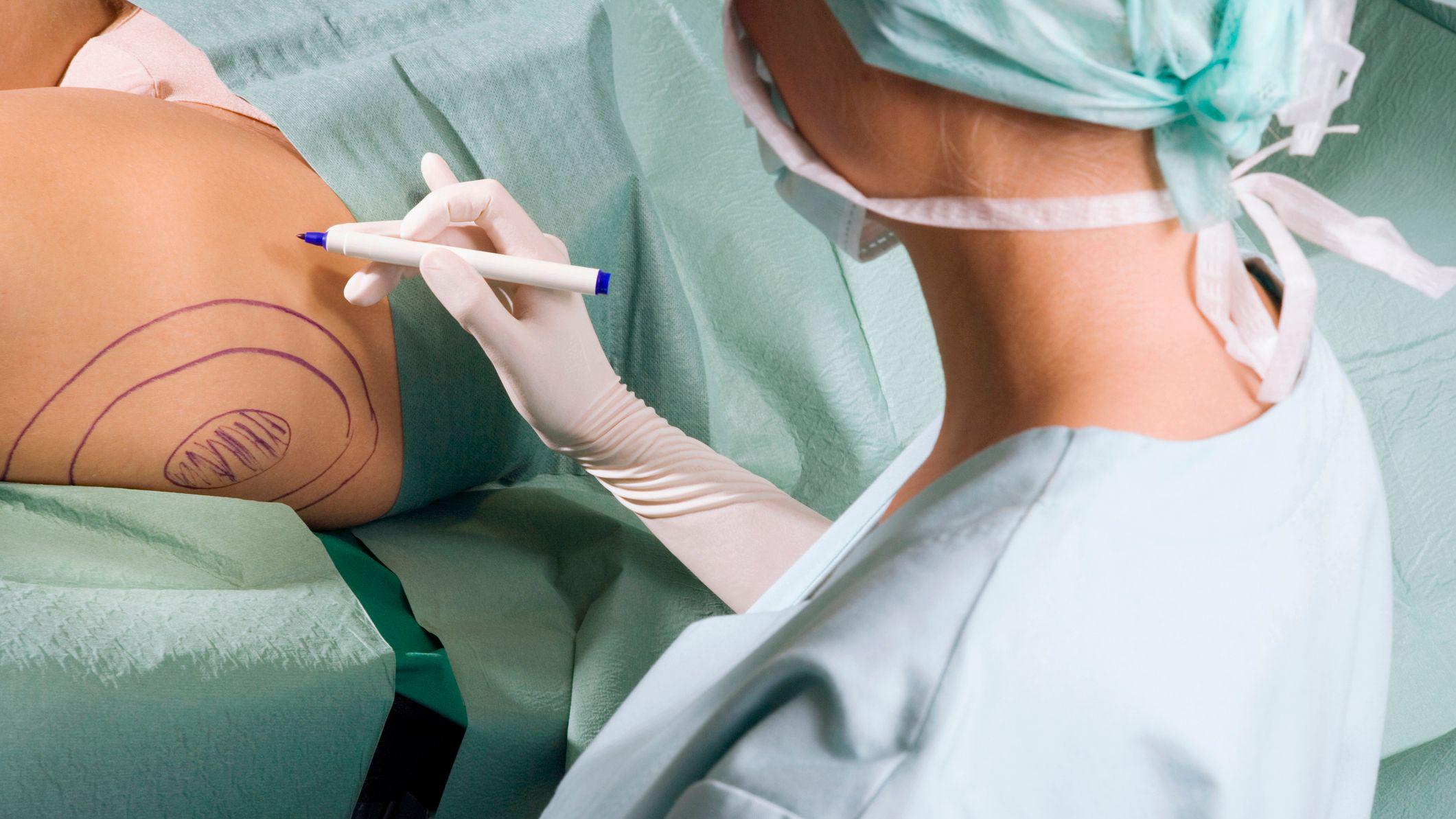 SK:N: Why has the cosmetic surgery chain gone bust?