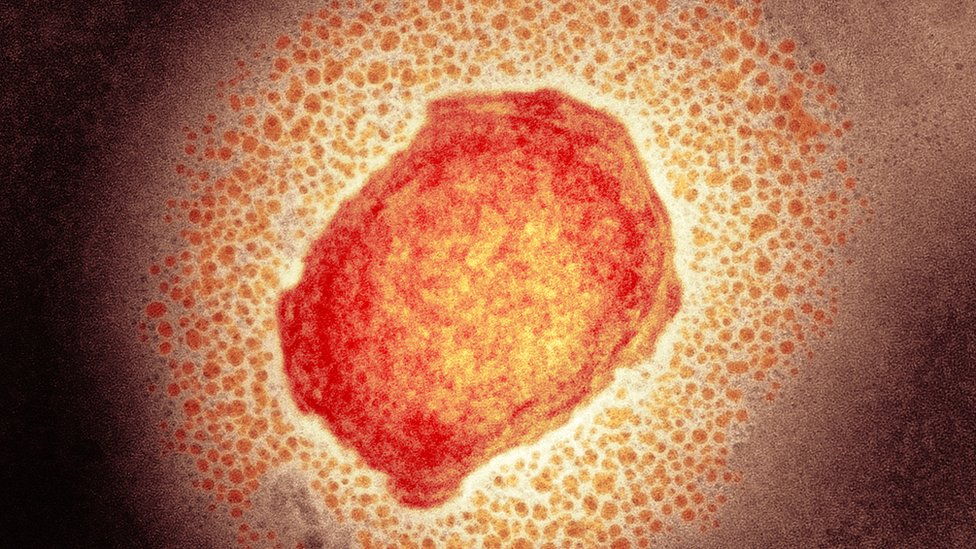 Monkeypox virus particle.