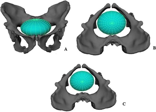 Reconstrucción digital de la pelvis de Australopithecus sediba