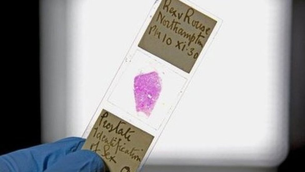 Слайд с образцом ткани жертвы Альфреда Роуза