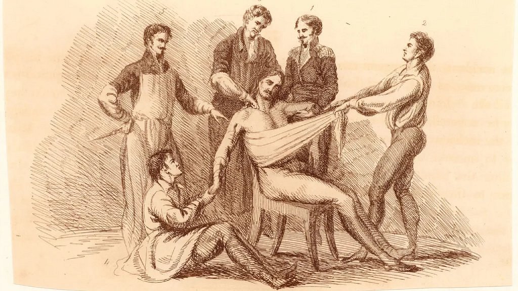 Ilustração mostra paciente segurado por cinco homens