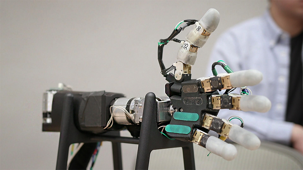The 'mind-bending' bionic arm powered by AI