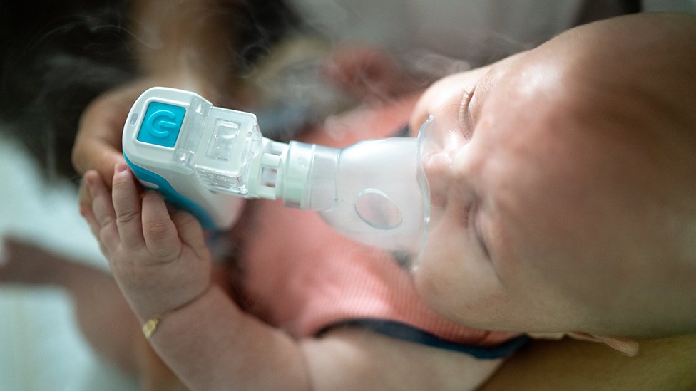 Um bebê com uma máscara de nebulização