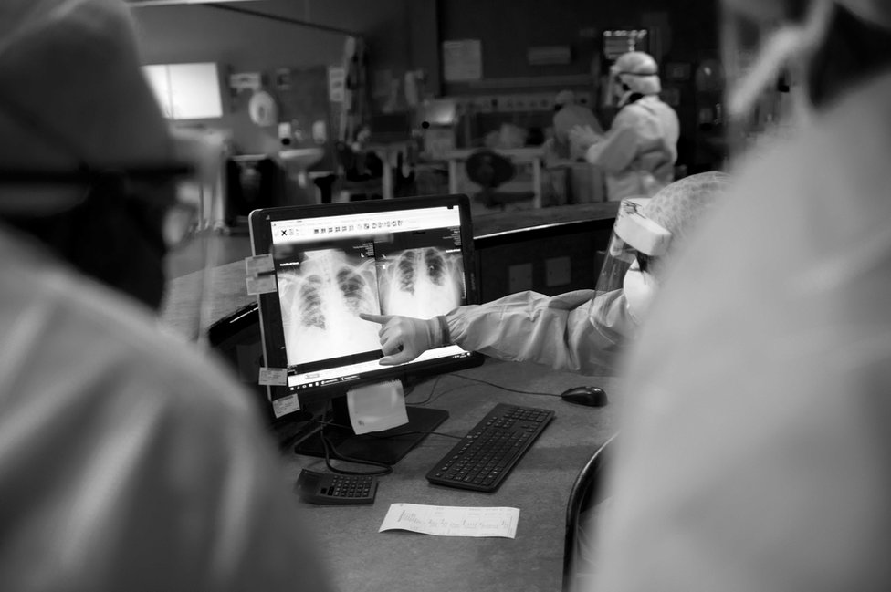 Рентгеновский снимок пациента исследуется на наличие жидкости, чтобы решить, можно ли его снять с респиратора.