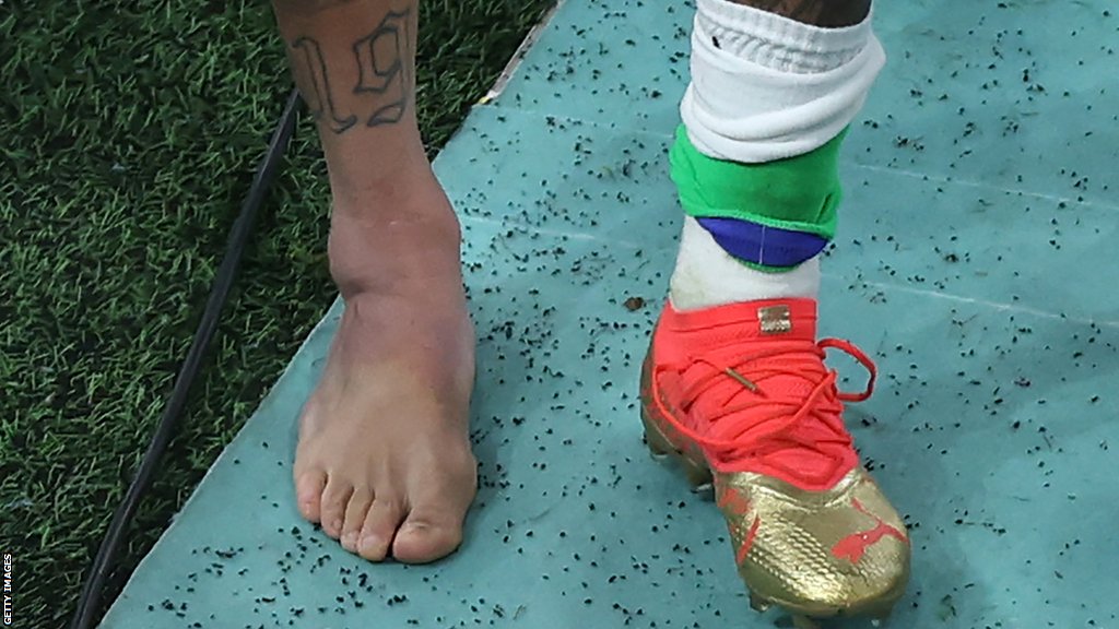 Neymar removed his footwear to display a heavily swollen ankle after being substituted near the end of Brazil's win over Serbia