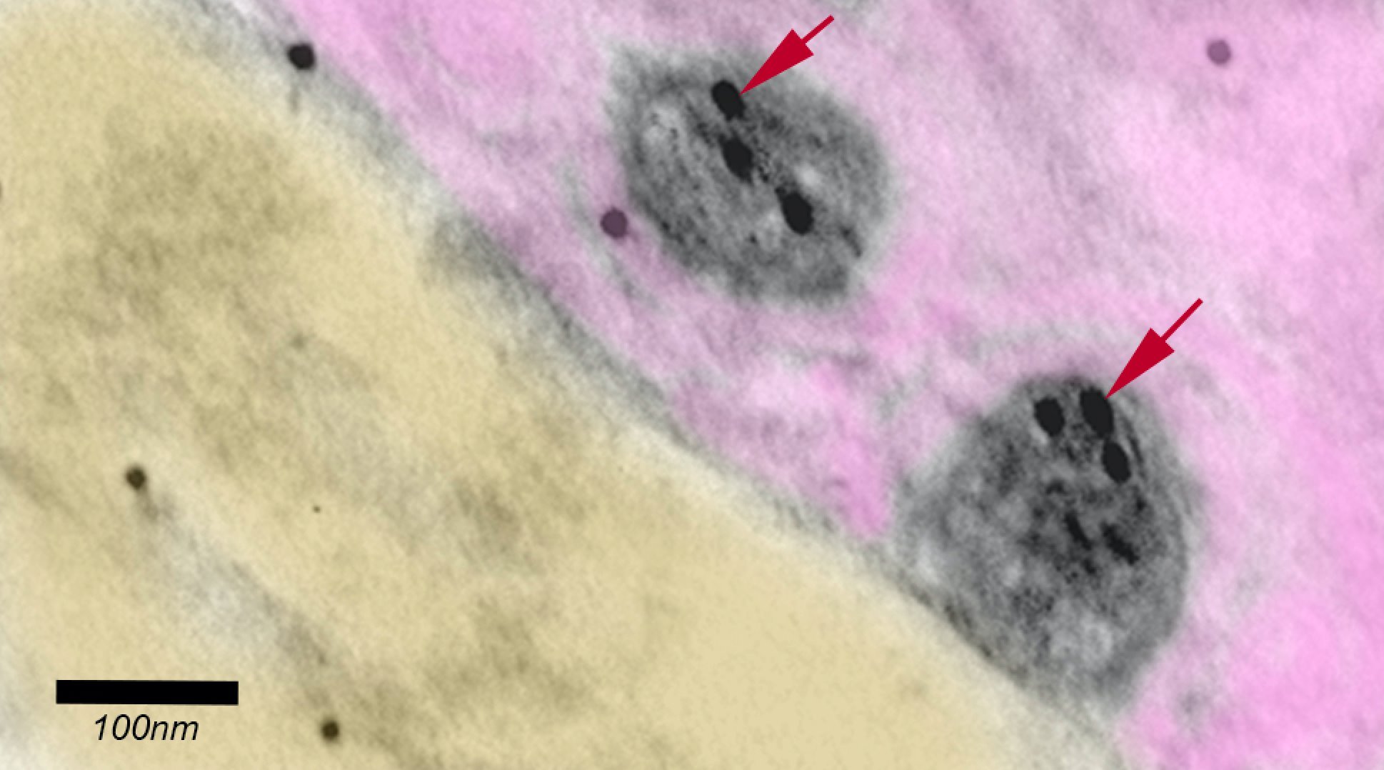 Imagem de microscopia eletrônica colorida artificialmente mostrando dois vírus Sars-Cov-2