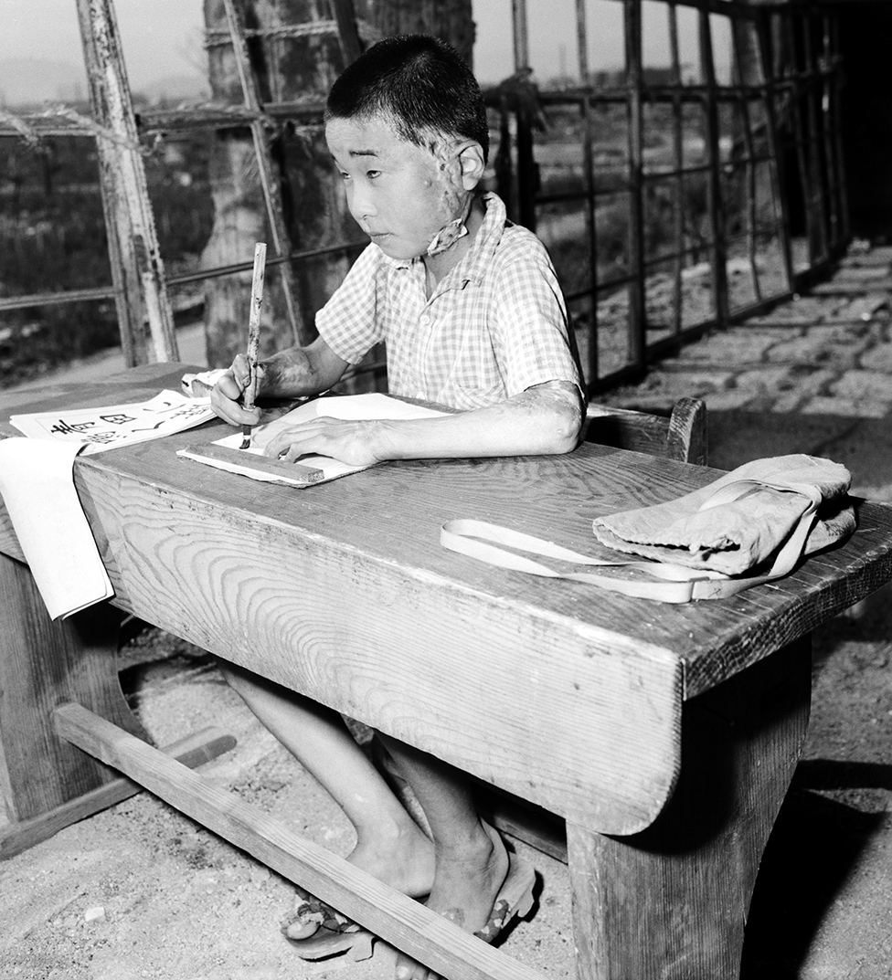 A child with scars writes on paper in a bomb-damaged classroom