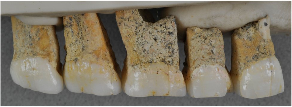 Зубы человека luzonensis