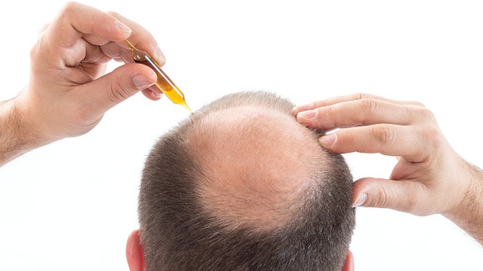 Homem com alopecia aplica ampola com um produto na cabeça