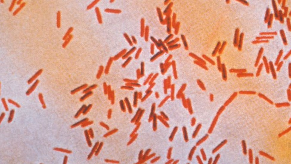 A photomicrograph of Salmonella typhi bacteria using a Gram-stain technique
