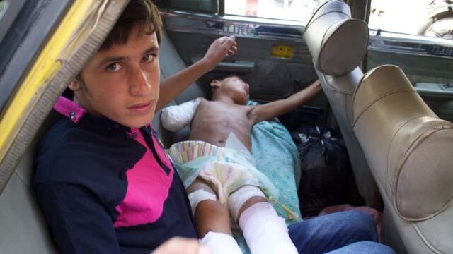 8-летний Хани Джадид лежит в такси, которое нужно отвезти из больницы, Алеппо, сентябрь 2016 г.