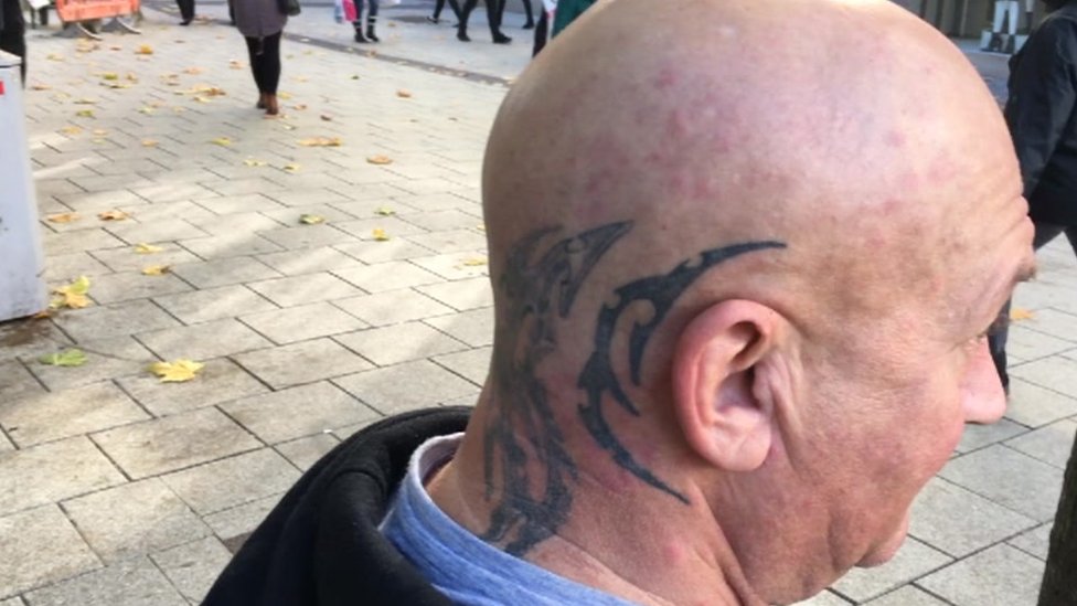 Man with tattoo on his head