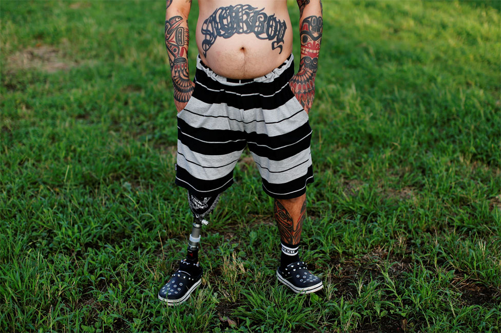 Мужчина в шортах стоит на траве, показывая протез и татуировку