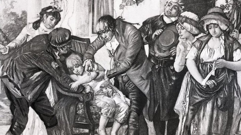 Первая вакцинация против оспы, сделанная английским врачом Эдвардом Дженнером Джеймсу Фиппсу в 1796 году. С картины Дж. Г. Мелинги
